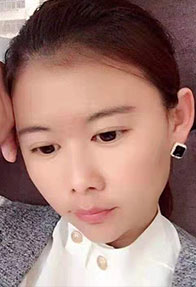 靓雅洁代理风采
